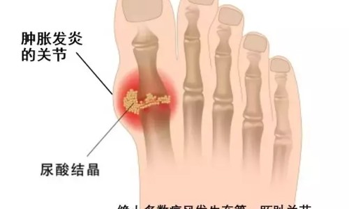 鼻粘膜溃烂症状网 | 鼻粘膜增厚有什么症状,鼻粘膜糜烂的症状有哪些